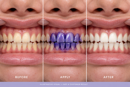 Purple Teeth Colour-Correcting Serum